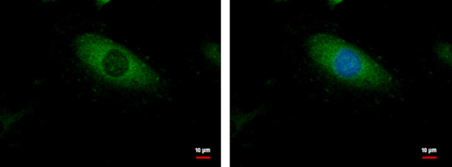 p130Cas Antibody in Immunocytochemistry (ICC/IF)