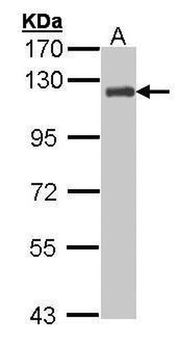 p130Cas Antibody in Western Blot (WB)