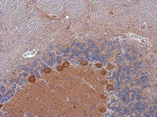 p130Cas Antibody in Immunohistochemistry (Paraffin) (IHC (P))