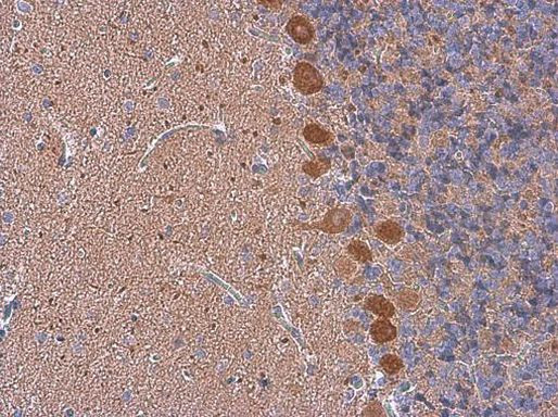 p130Cas Antibody in Immunohistochemistry (Paraffin) (IHC (P))