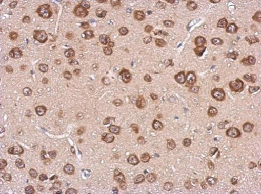 Cystatin F Antibody in Immunohistochemistry (Paraffin) (IHC (P))