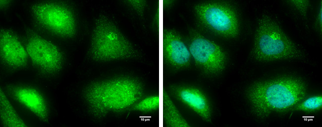 TRIM25 Antibody in Immunocytochemistry (ICC/IF)