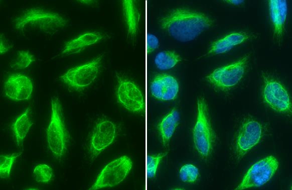 Vimentin Antibody in Immunocytochemistry (ICC/IF)