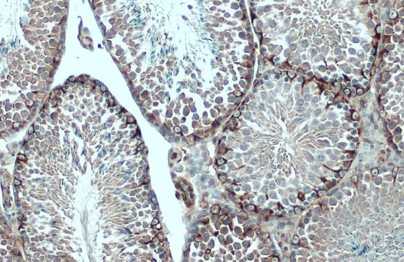 Vimentin Antibody in Immunohistochemistry (Paraffin) (IHC (P))