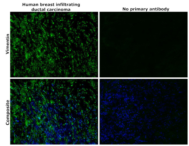 Vimentin Antibody in Immunohistochemistry (Paraffin) (IHC (P))