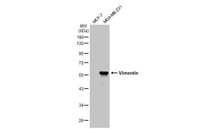 Vimentin Antibody in Western Blot (WB)