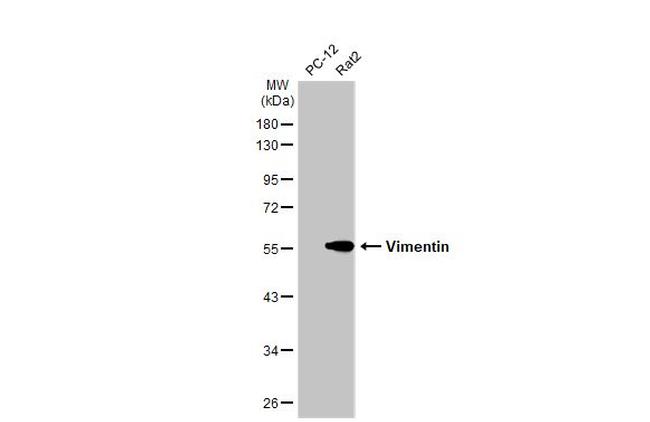 Vimentin Antibody in Western Blot (WB)