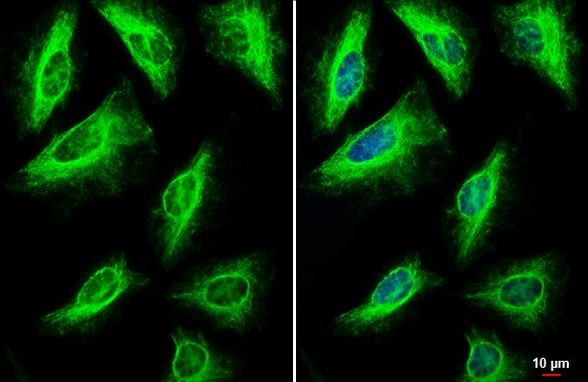 Vimentin Antibody in Immunocytochemistry (ICC/IF)