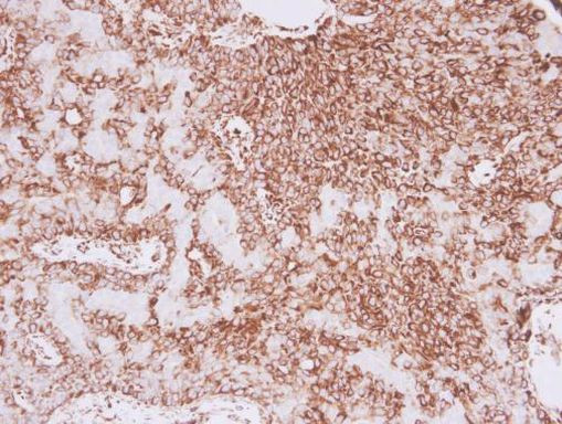 Vimentin Antibody in Immunohistochemistry (Paraffin) (IHC (P))