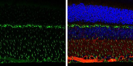 Vimentin Antibody in Immunohistochemistry (Paraffin) (IHC (P))