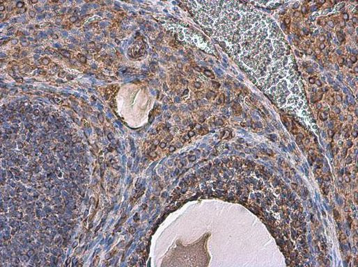 Vimentin Antibody in Immunohistochemistry (Paraffin) (IHC (P))