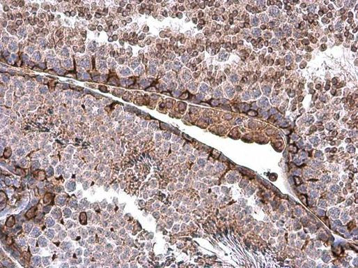 Vimentin Antibody in Immunohistochemistry (Paraffin) (IHC (P))