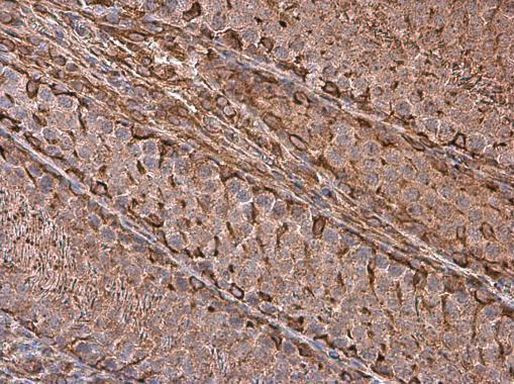 Vimentin Antibody in Immunohistochemistry (Paraffin) (IHC (P))