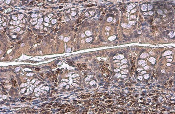 Vimentin Antibody in Immunohistochemistry (Paraffin) (IHC (P))