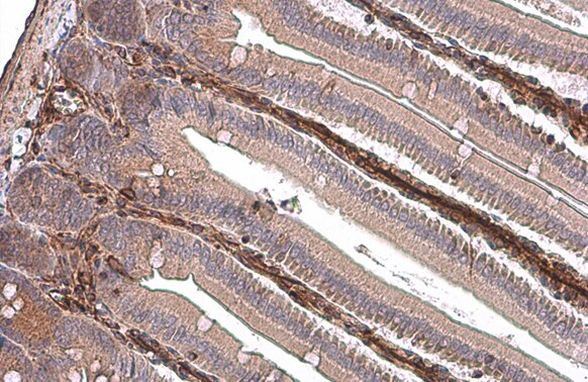 Vimentin Antibody in Immunohistochemistry (Paraffin) (IHC (P))