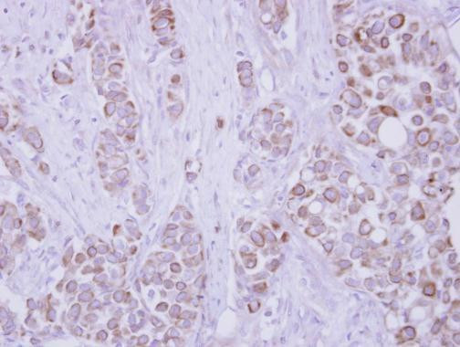 CD82 Antibody in Immunohistochemistry (Paraffin) (IHC (P))