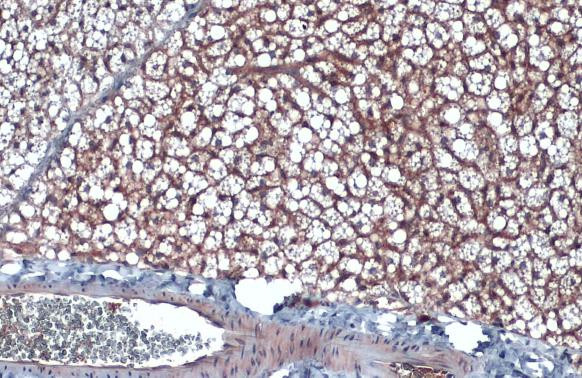 CD36 Antibody in Immunohistochemistry (Paraffin) (IHC (P))