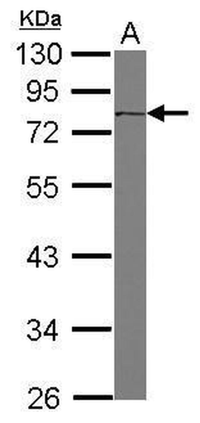 CD36 Antibody in Western Blot (WB)