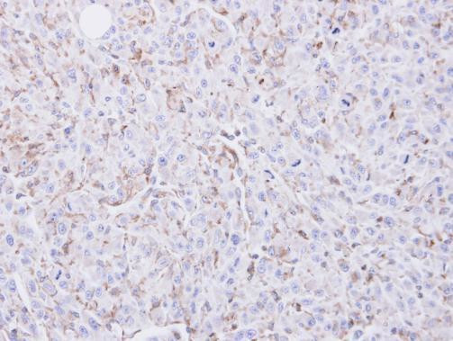 COX2 Antibody in Immunohistochemistry (Paraffin) (IHC (P))