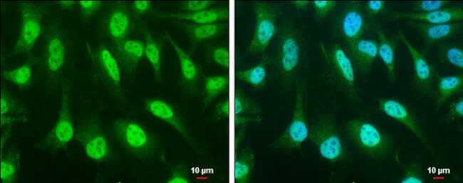 SOCS1 Antibody in Immunocytochemistry (ICC/IF)