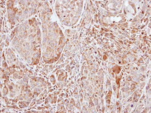 SOCS1 Antibody in Immunohistochemistry (Paraffin) (IHC (P))