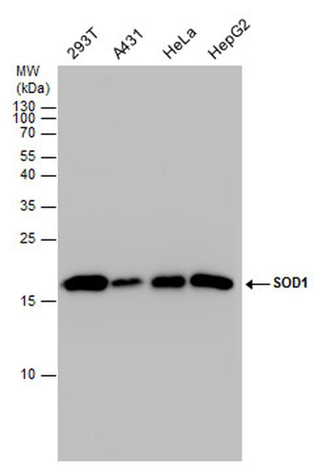 SOD1 Antibody in Western Blot (WB)