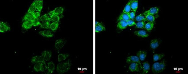 MMP13 Antibody in Immunocytochemistry (ICC/IF)