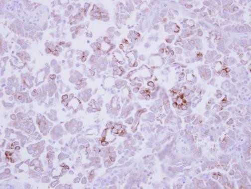 MMP13 Antibody in Immunohistochemistry (Paraffin) (IHC (P))