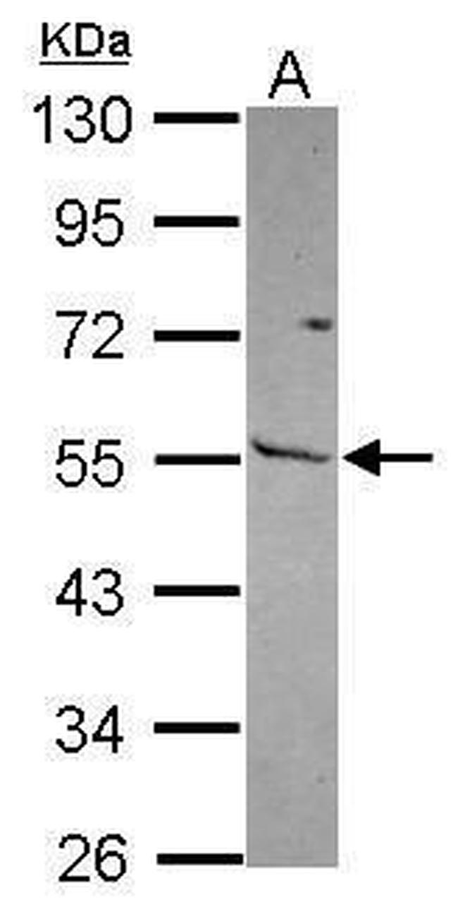 MMP13 Antibody in Western Blot (WB)