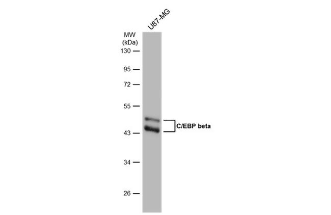 C/EBP beta Antibody in Western Blot (WB)