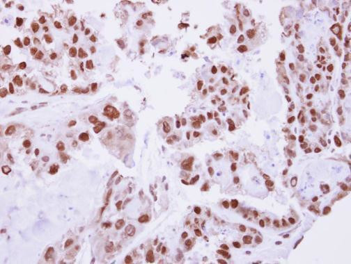 C/EBP beta Antibody in Immunohistochemistry (Paraffin) (IHC (P))