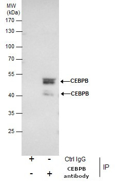 C/EBP beta Antibody in Western Blot (WB)