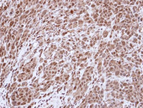 TOP2A Antibody in Immunohistochemistry (Paraffin) (IHC (P))