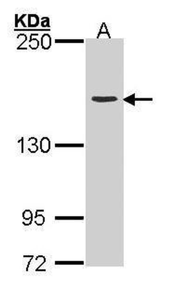 TOP2A Antibody in Western Blot (WB)