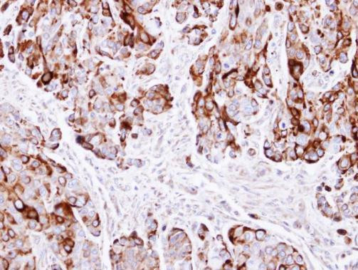 Cytokeratin 20 Antibody in Immunohistochemistry (Paraffin) (IHC (P))