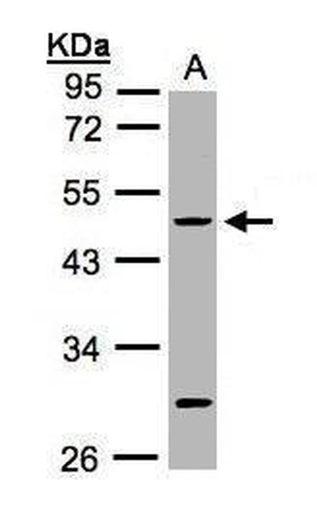 Cytokeratin 20 Antibody in Western Blot (WB)