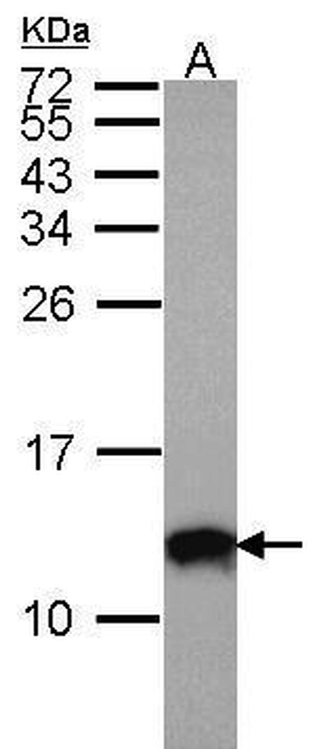 S100A10 Antibody in Western Blot (WB)