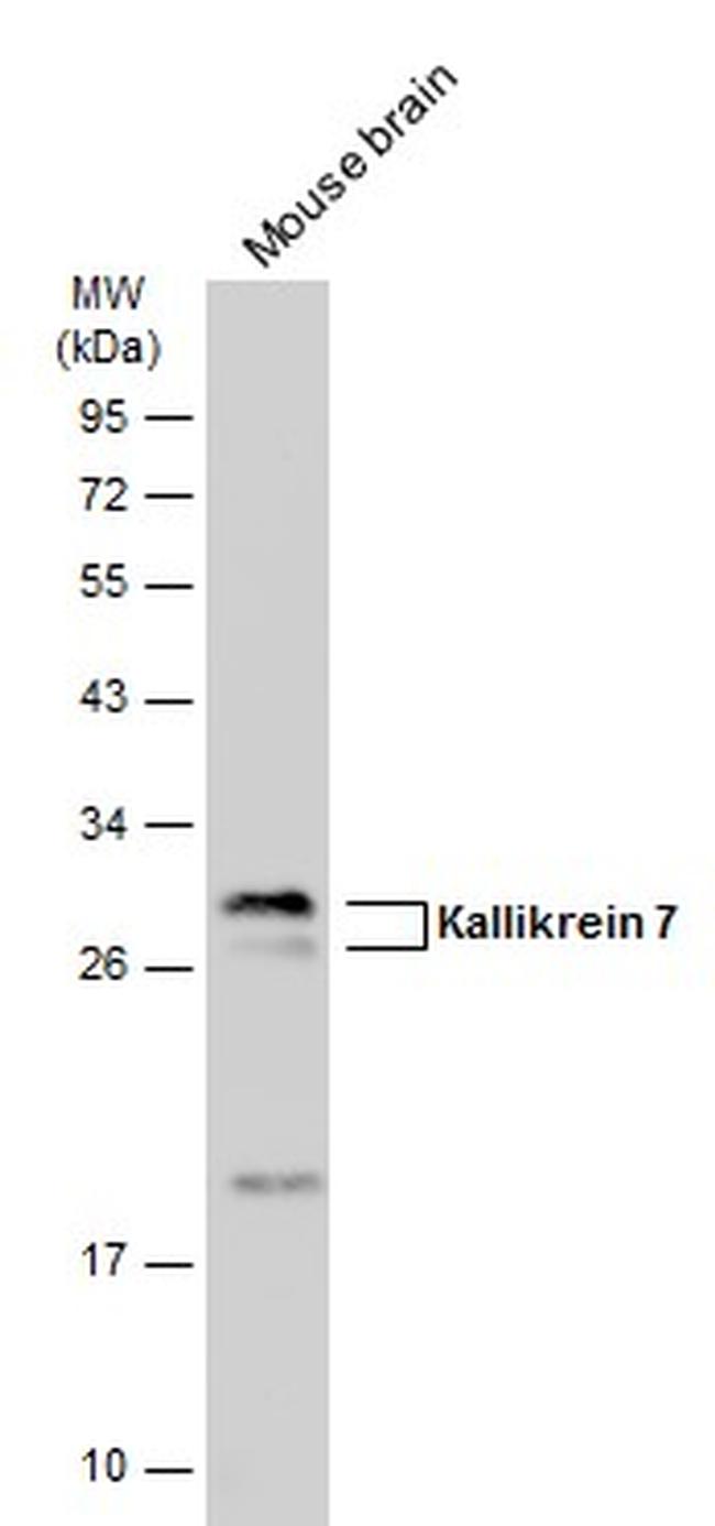 Kallikrein 7 Antibody in Western Blot (WB)