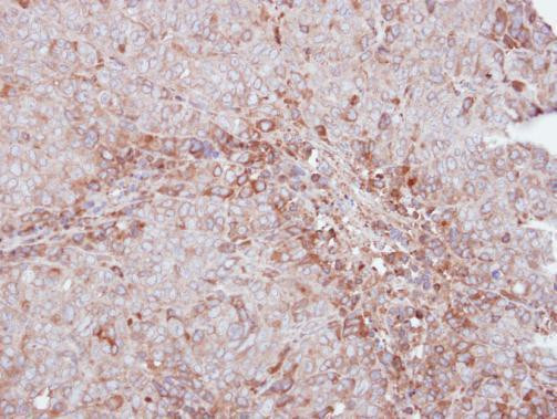 MMP12 Antibody in Immunohistochemistry (Paraffin) (IHC (P))