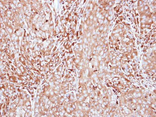 MMP3 Antibody in Immunohistochemistry (Paraffin) (IHC (P))