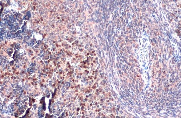 TLR9 Antibody in Immunohistochemistry (Paraffin) (IHC (P))