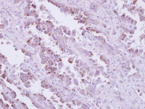 TLR9 Antibody in Immunohistochemistry (Paraffin) (IHC (P))