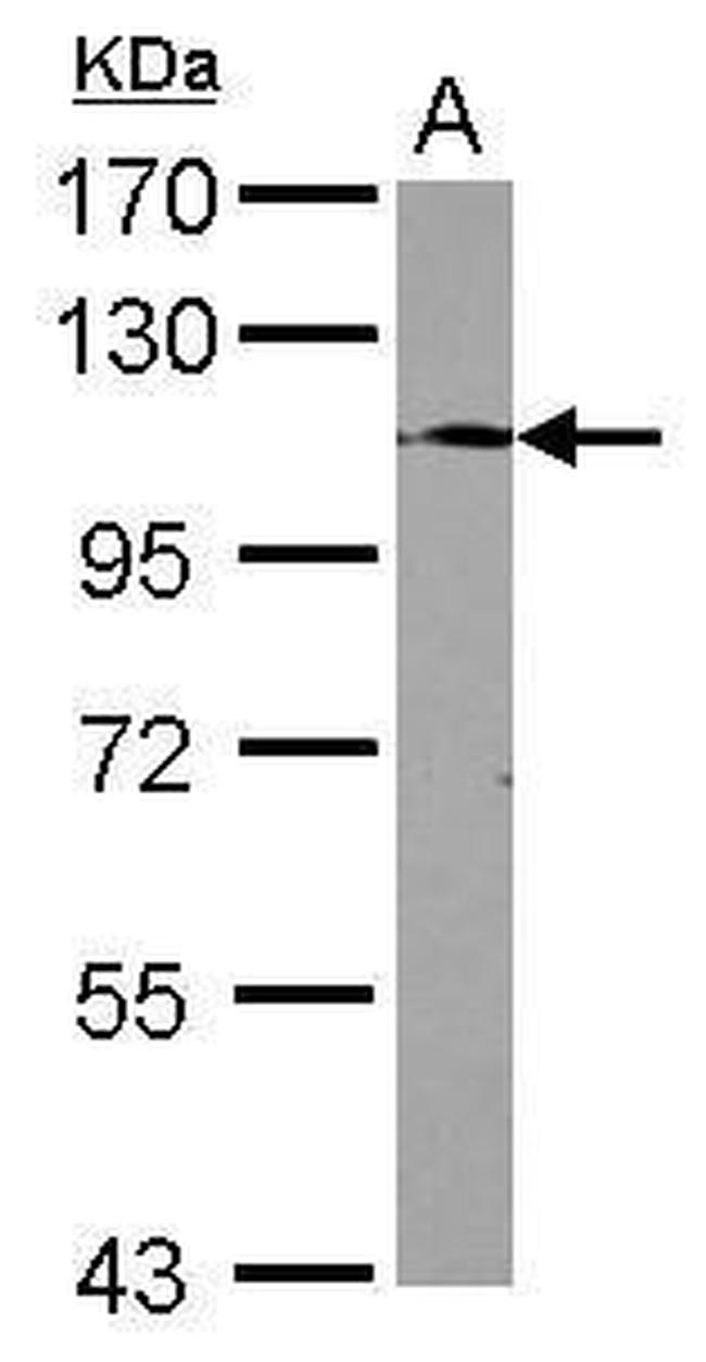 TLR9 Antibody in Western Blot (WB)