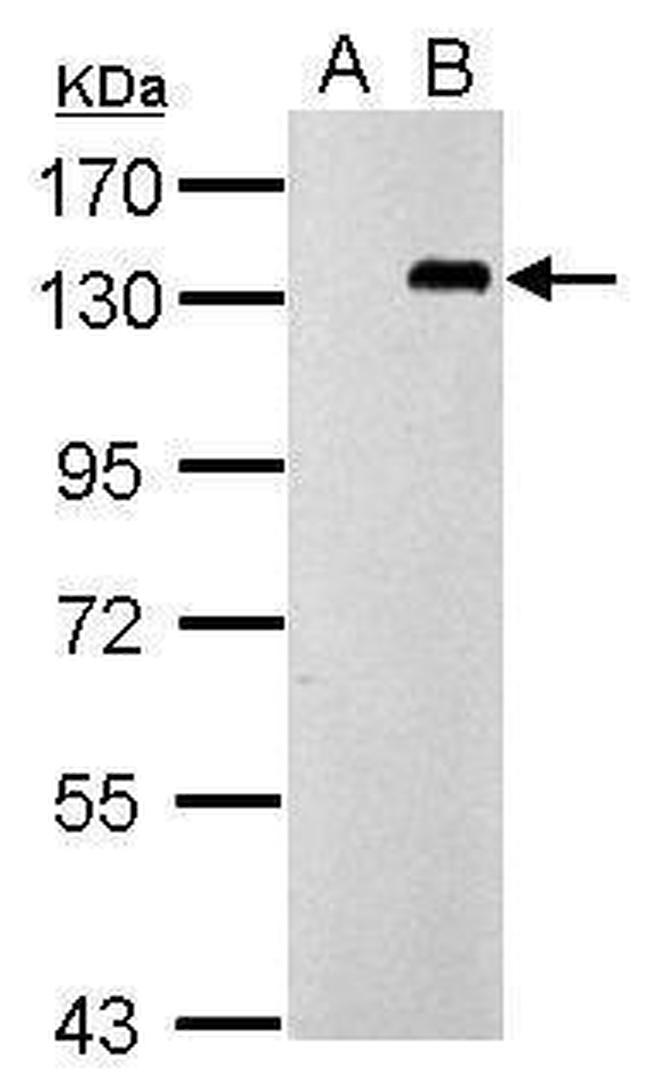 TLR9 Antibody in Western Blot (WB)