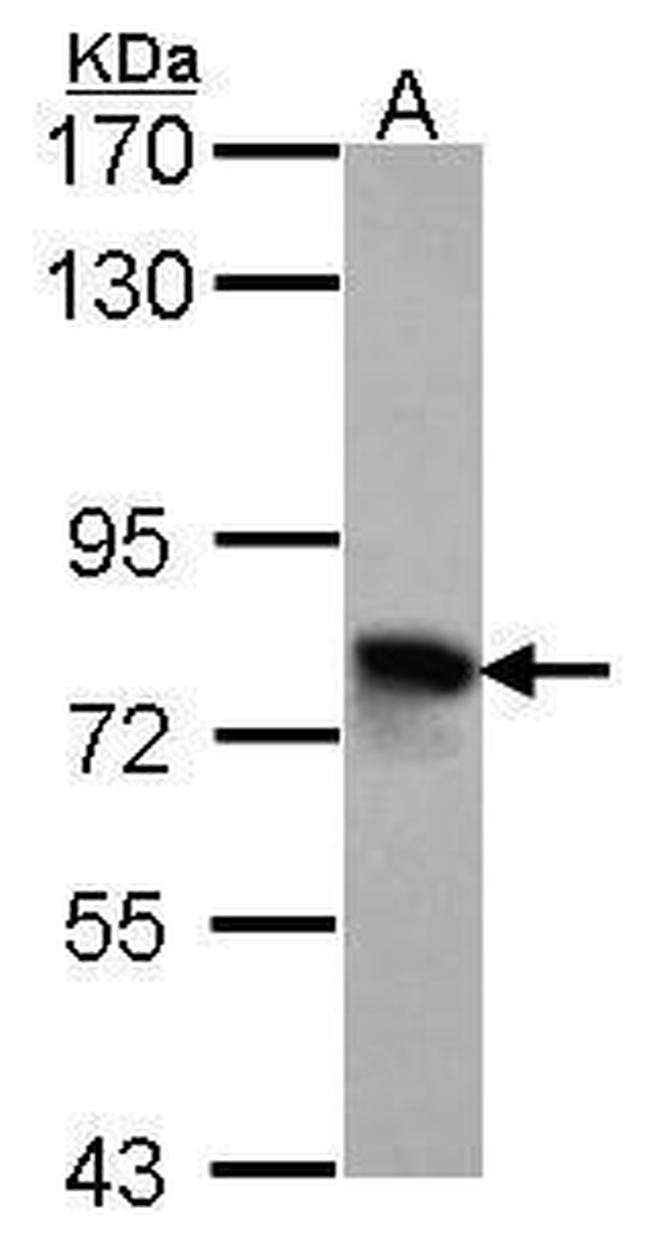 TGFBI Antibody in Western Blot (WB)