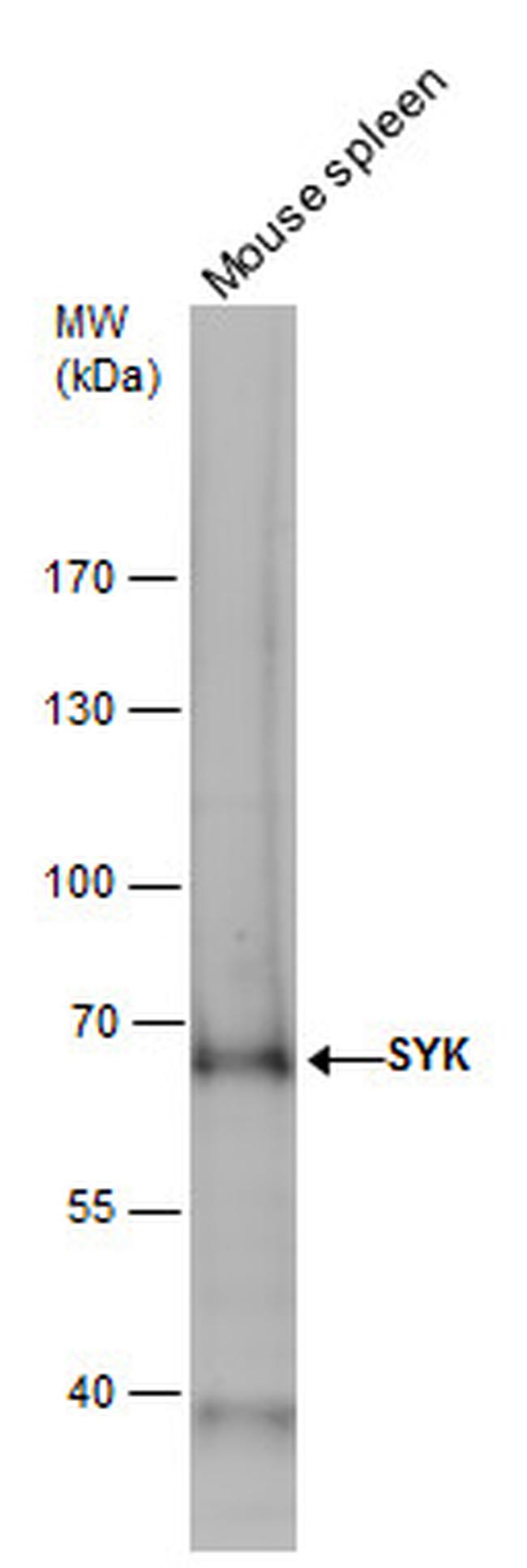 Syk Antibody in Western Blot (WB)