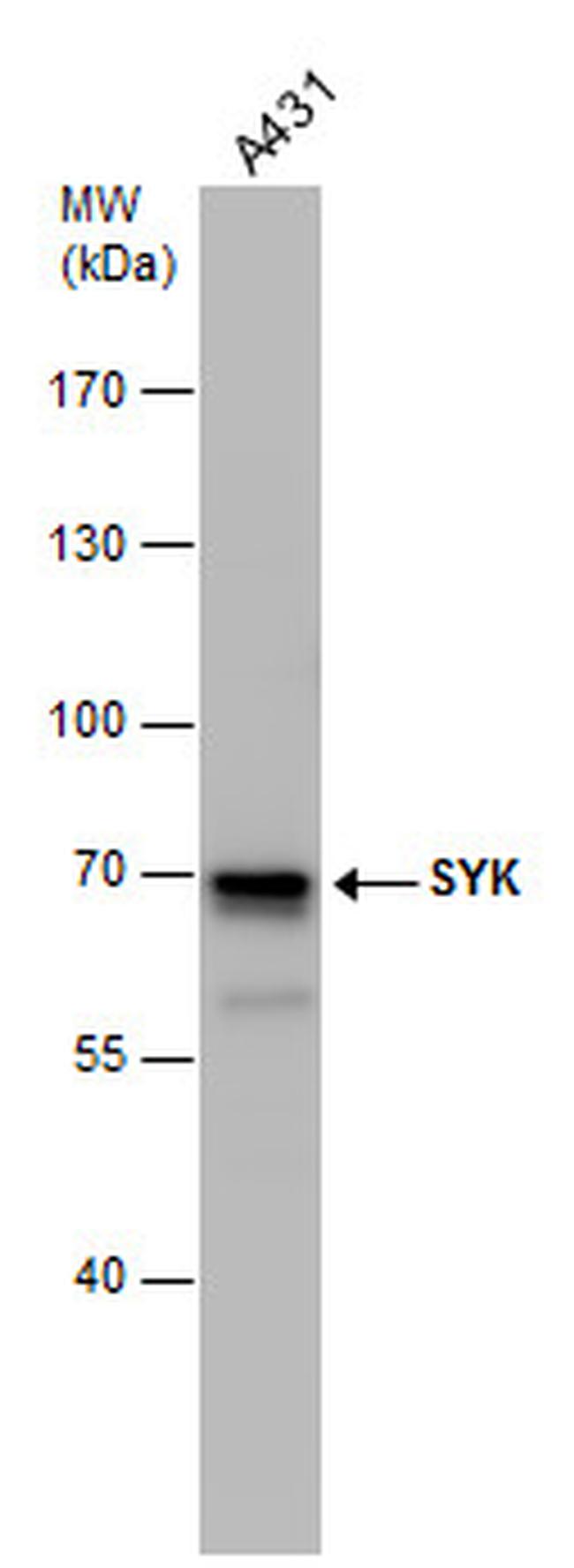 Syk Antibody in Western Blot (WB)