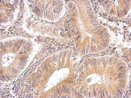 RRM1 Antibody in Immunohistochemistry (Paraffin) (IHC (P))