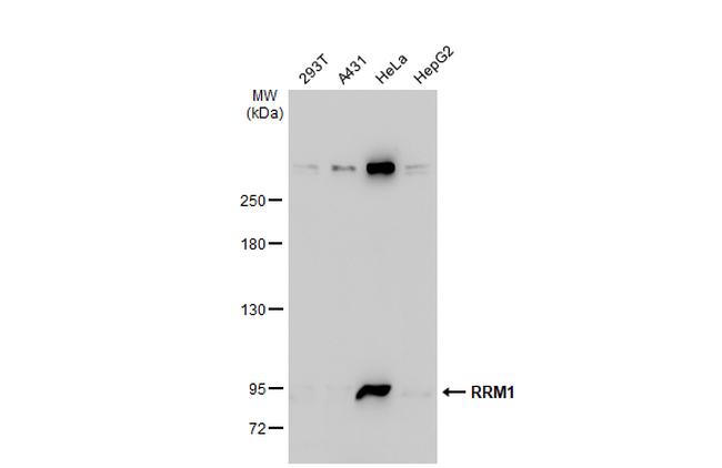 RRM1 Antibody in Western Blot (WB)