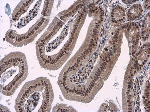 PBRM1 Antibody in Immunohistochemistry (Paraffin) (IHC (P))